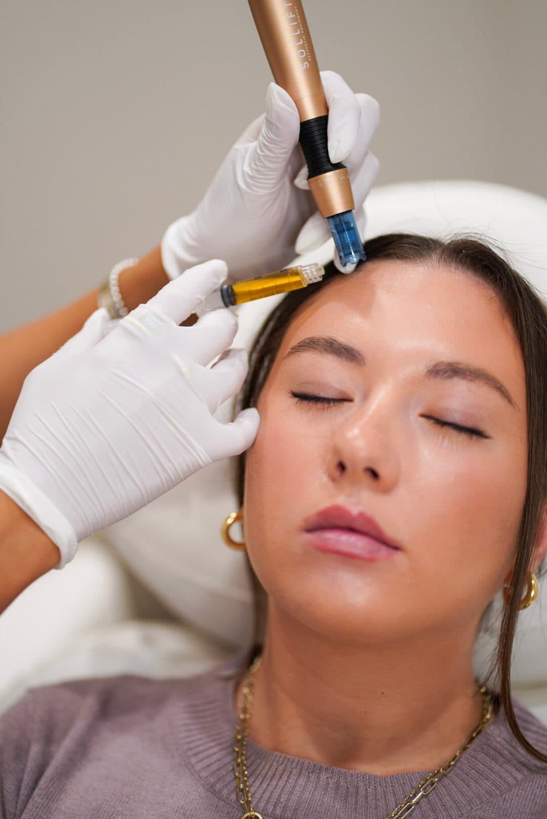Microneedling device being used across a client's forehead during treatment